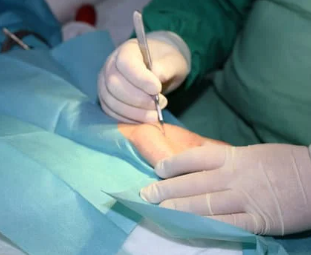 Carpal Tunnel Syndrome (CTS)